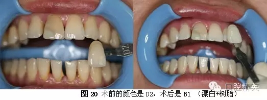 640.webp (11).jpg 640.webp (11).jpg