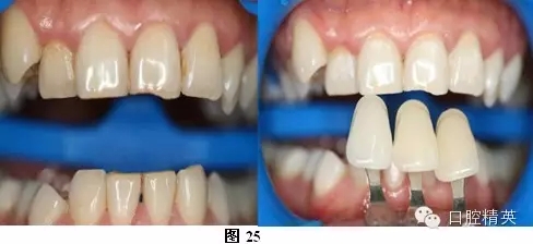 640.webp (16).jpg 640.webp (16).jpg