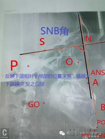 640.webp.jpg 640.webp.jpg