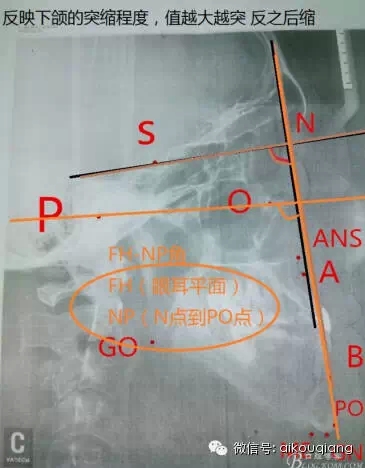 640.webp (2).jpg 640.webp (2).jpg