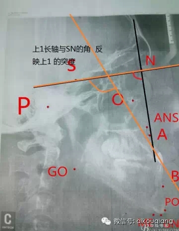 640.webp (4).jpg 640.webp (4).jpg