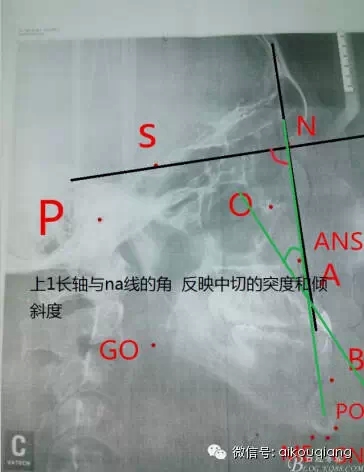 640.webp (6).jpg 640.webp (6).jpg