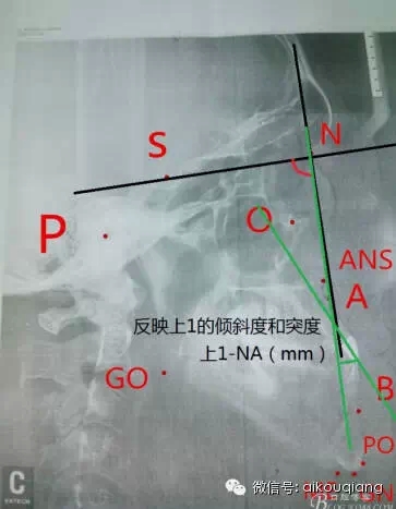 640.webp (7).jpg 640.webp (7).jpg