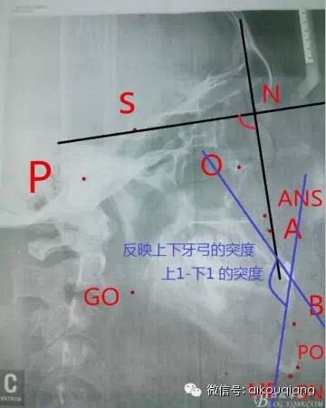 640.webp (10).jpg 640.webp (10).jpg