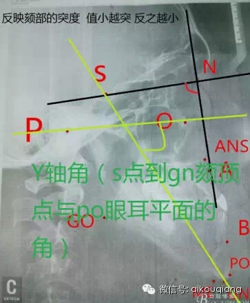 640.webp (12).jpg 640.webp (12).jpg