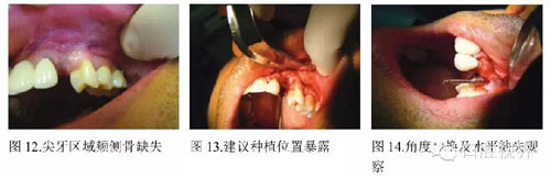 知道PRP?知道PRF?知道CGF? 知道PRP?知道PRF?知道CGF?