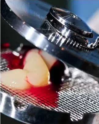 知道PRP?知道PRF?知道CGF? 知道PRP?知道PRF?知道CGF?