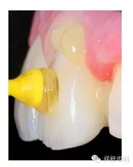 11.webp.jpg 11.webp.jpg