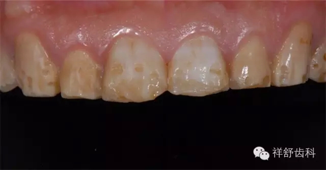 16.webp.jpg 16.webp.jpg