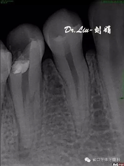 1.webp.jpg 1.webp.jpg