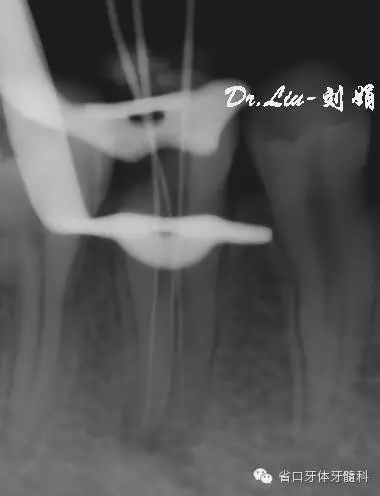 5.webp.jpg 5.webp.jpg