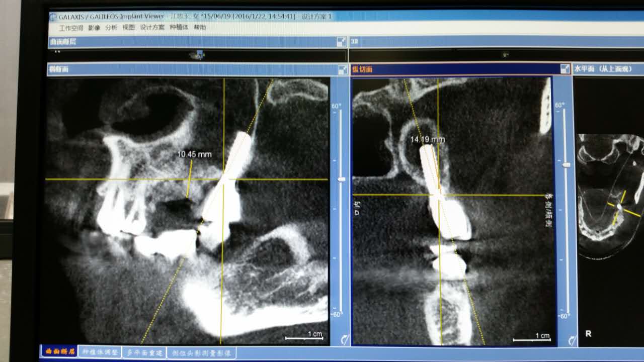 webwxgetmsgimg (1).jpg webwxgetmsgimg (1).jpg