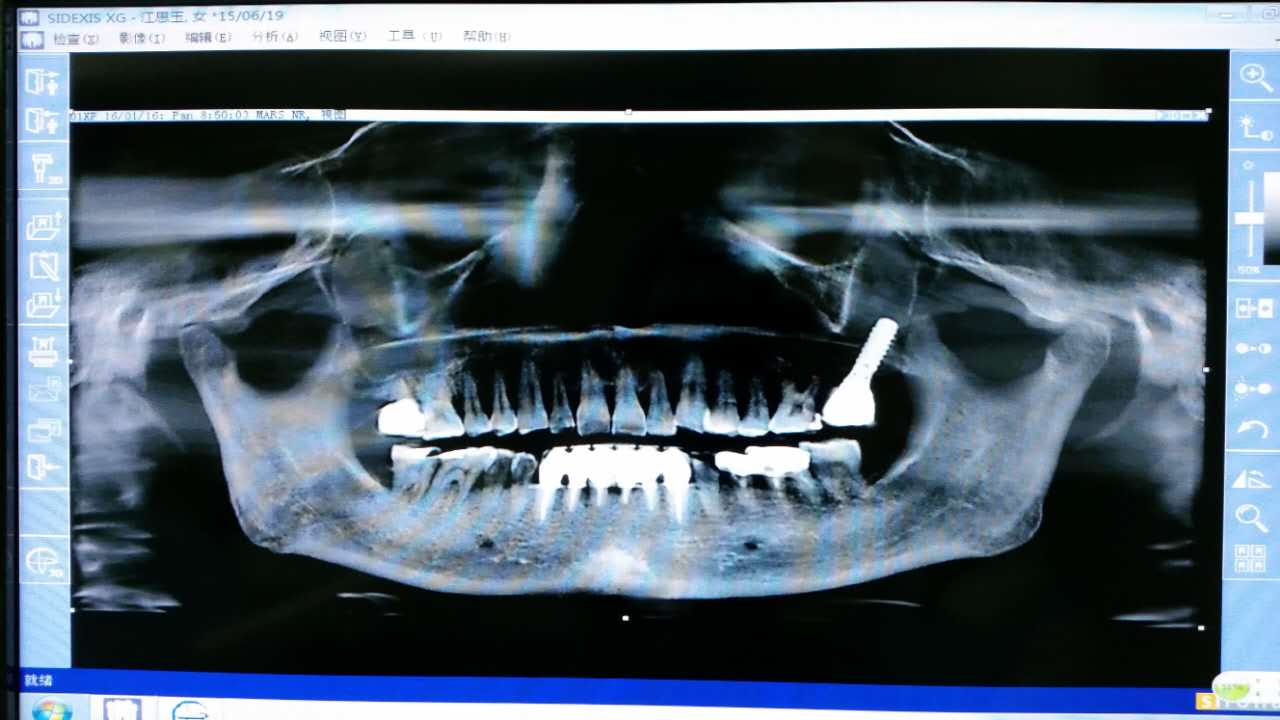 webwxgetmsgimg.jpg webwxgetmsgimg.jpg