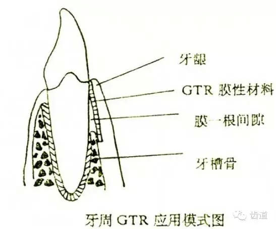 3.webp.jpg 3.webp.jpg