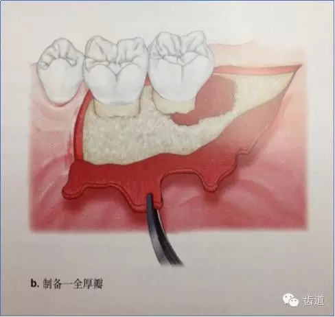 7.webp.jpg 7.webp.jpg