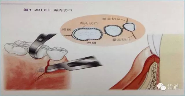 13.webp.jpg 13.webp.jpg