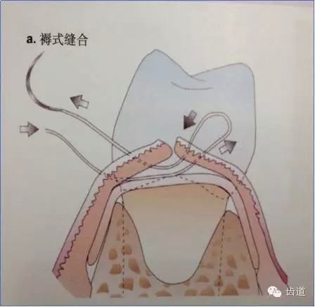 16.webp.jpg 16.webp.jpg