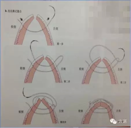 17.webp.jpg 17.webp.jpg