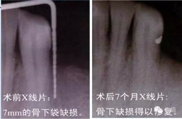 18.webp.jpg 18.webp.jpg