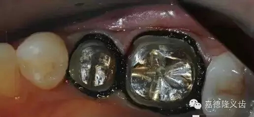 15.webp.jpg 15.webp.jpg