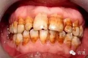 1.webp.jpg 1.webp.jpg