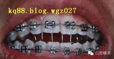 4.webp.jpg 4.webp.jpg