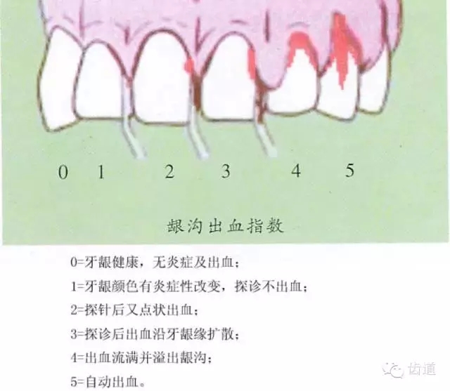 5.webp.jpg 5.webp.jpg