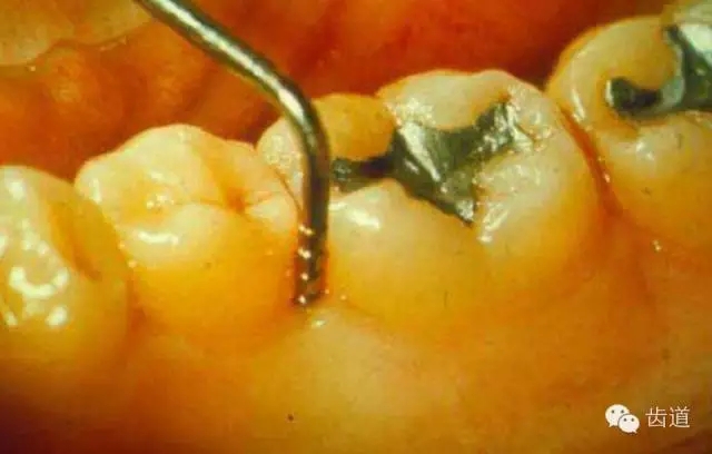 6.webp.jpg 6.webp.jpg