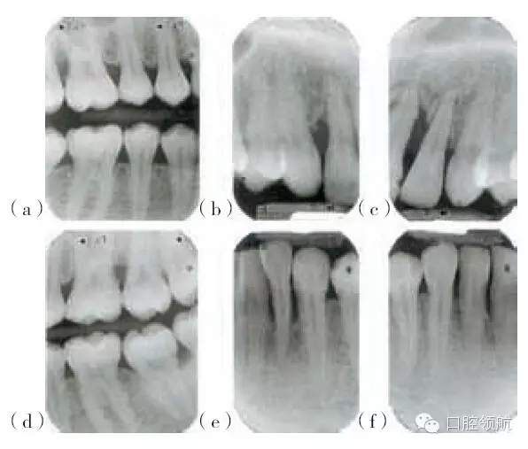 6.webp.jpg 6.webp.jpg