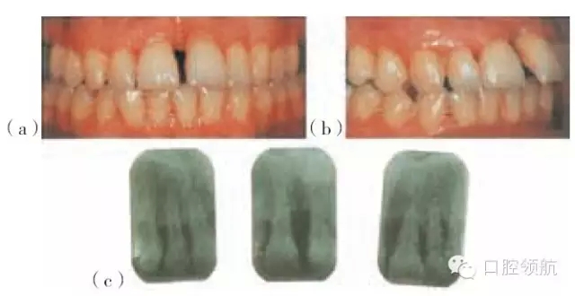 11.webp.jpg 11.webp.jpg