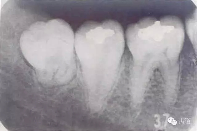 7.webp.jpg 7.webp.jpg