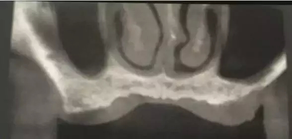 2.webp.jpg 2.webp.jpg