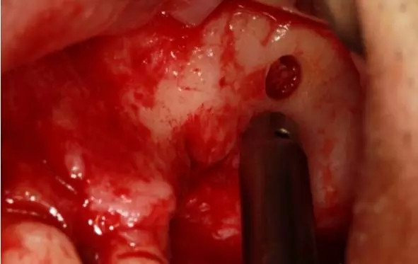 3.webp.jpg 3.webp.jpg