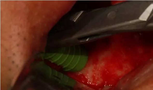 5.webp.jpg 5.webp.jpg