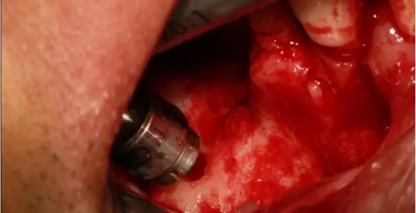 6.webp.jpg 6.webp.jpg