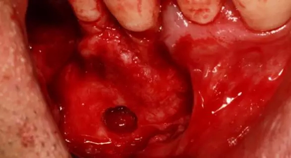 9.webp.jpg 9.webp.jpg