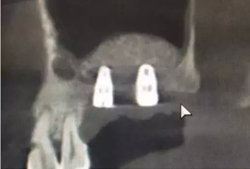 11.webp.jpg 11.webp.jpg