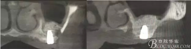 12.webp.jpg 12.webp.jpg