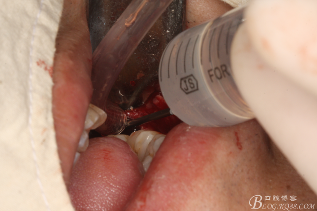 20141021204446_24938.jpg 20141021204446_24938.jpg