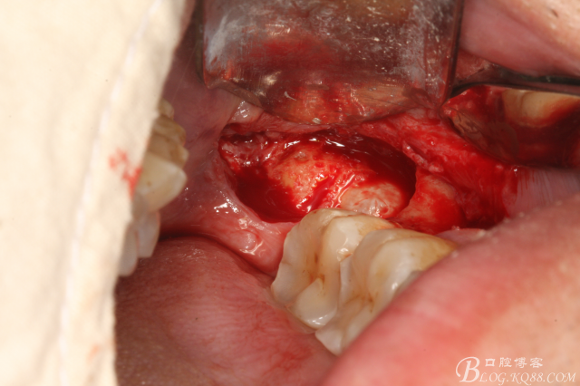 20141021205149_11473.jpg 20141021205149_11473.jpg