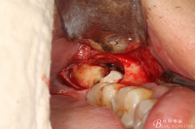 20141021205156_99465.jpg 20141021205156_99465.jpg