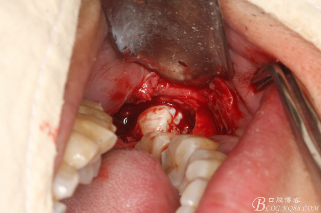 20141021205220_79004.jpg 20141021205220_79004.jpg