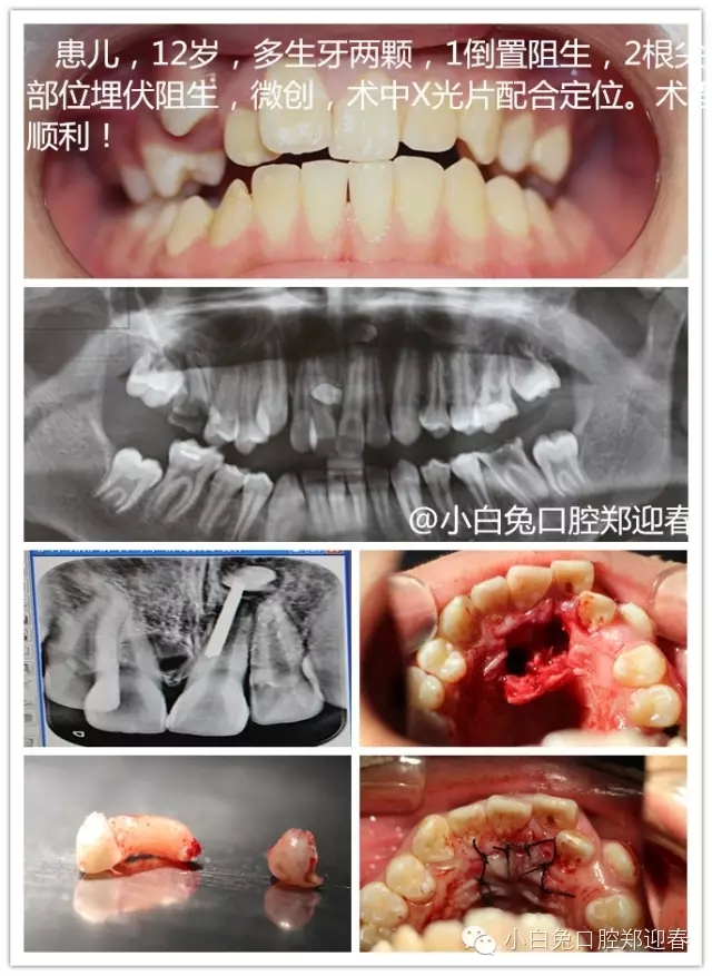 640.webp (2).jpg 640.webp (2).jpg