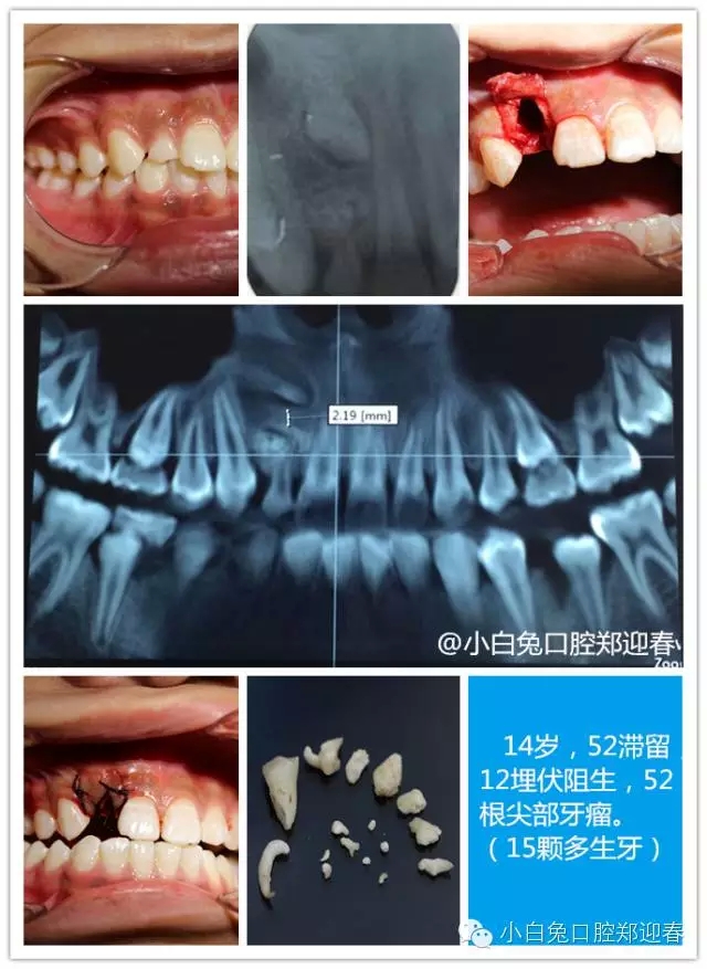 640.webp (3).jpg 640.webp (3).jpg