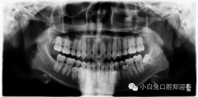 640.webp (6).jpg 640.webp (6).jpg