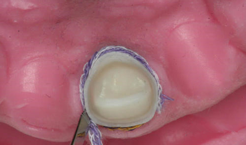 640 (5).png 640 (5).png