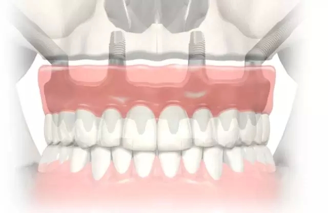 9.webp.jpg 9.webp.jpg