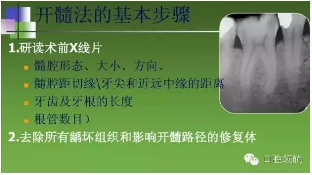 開(kāi)髓術(shù) 開(kāi)髓術(shù)