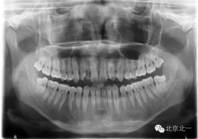 1.webp.jpg 1.webp.jpg