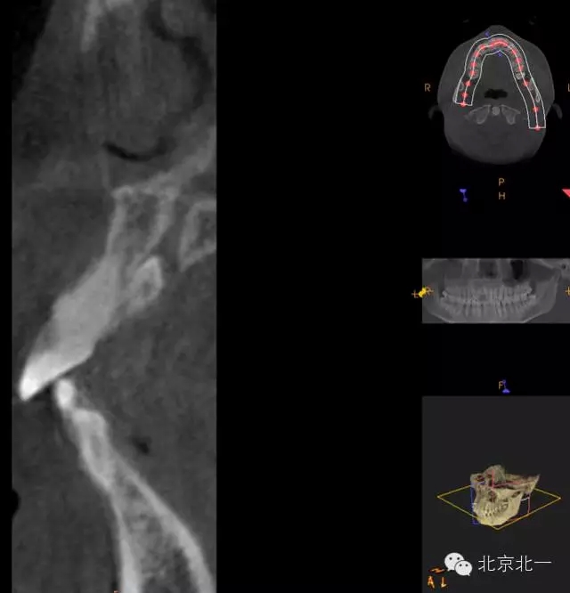 3.webp.jpg 3.webp.jpg